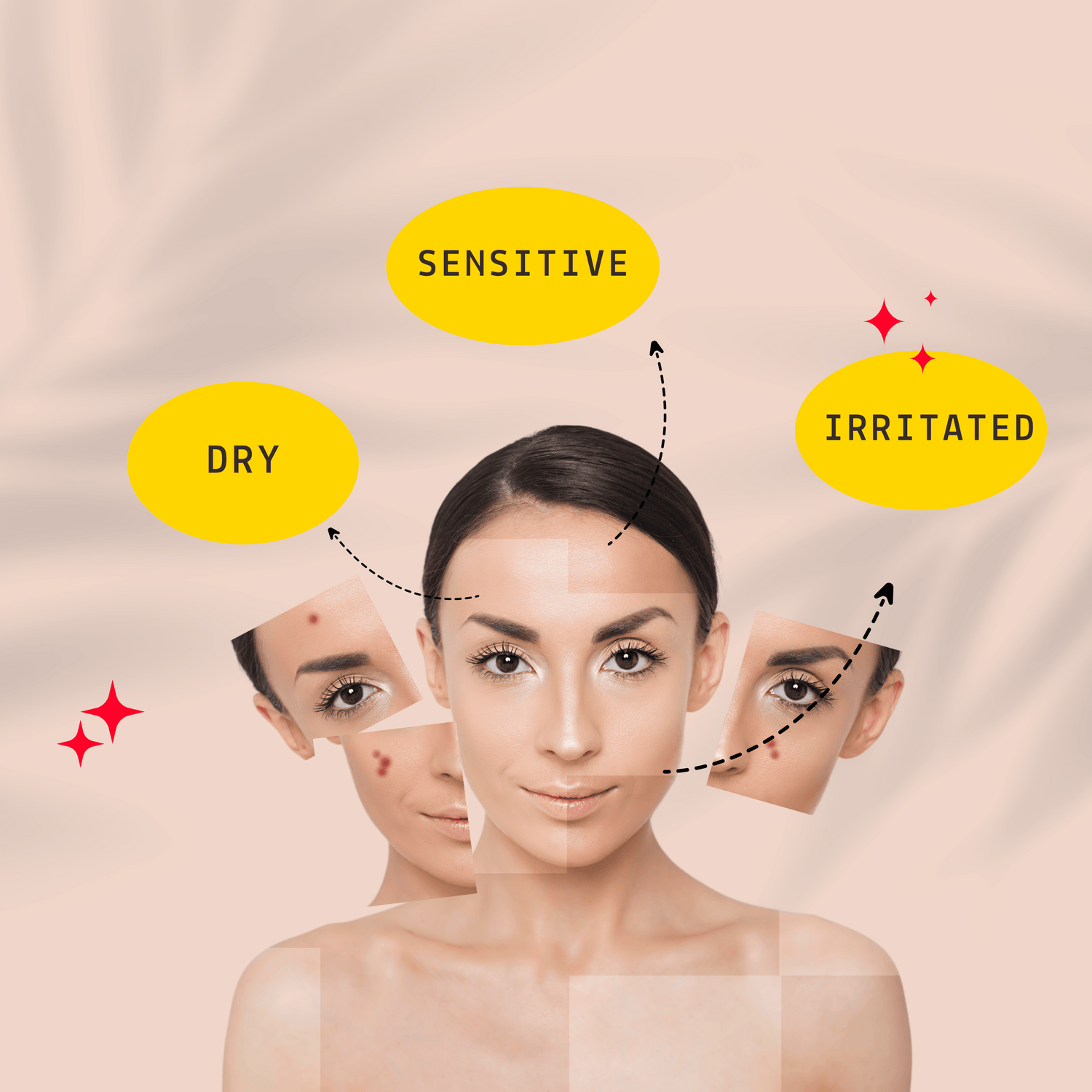 What is skin barrier ?